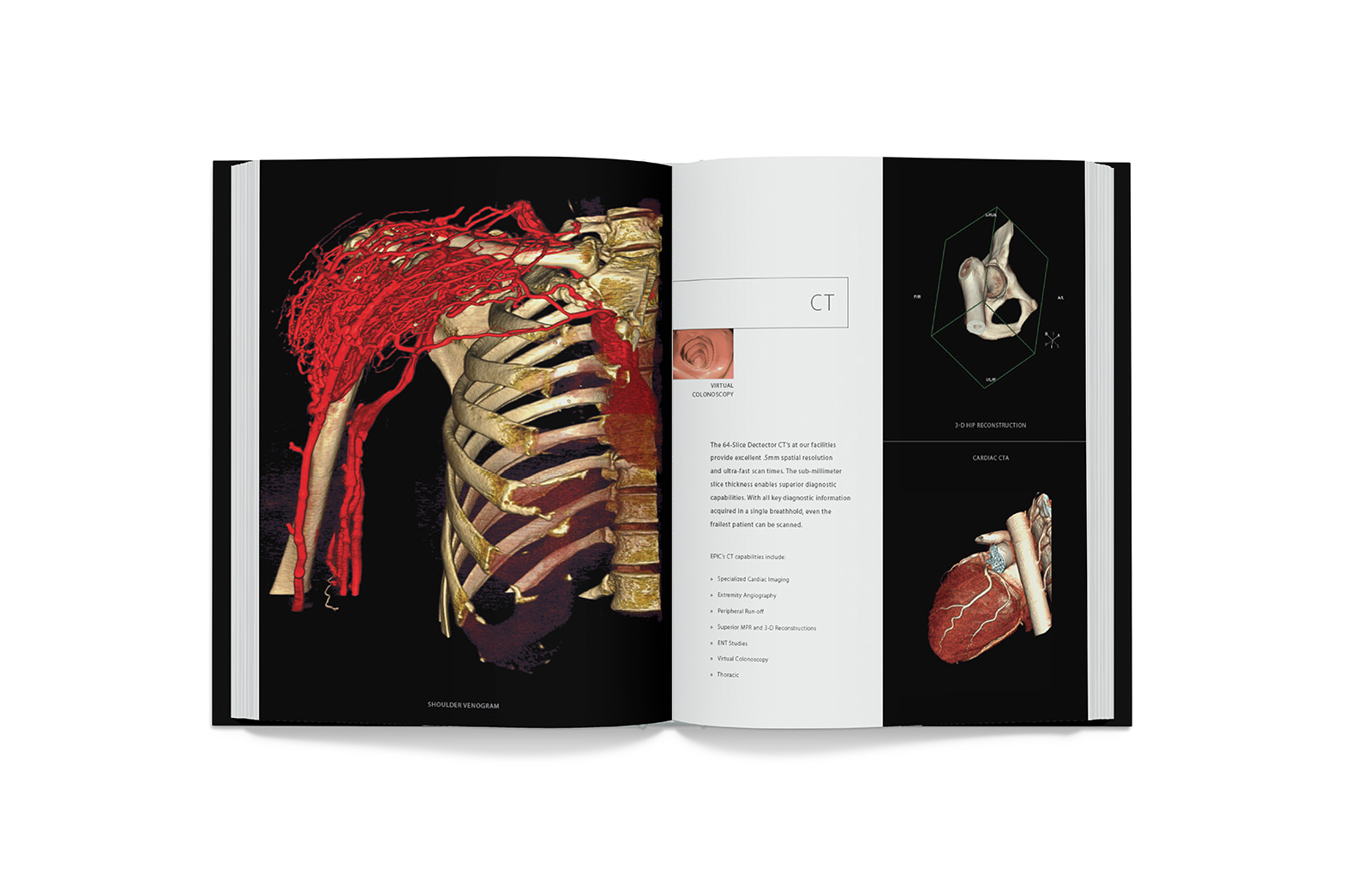 Book design. Epic leave behind book spread 2. This shows different scan technologies and imaging capabilities. By William Moschell Design Works. Honolulu, Hawaii medical book graphic designer.